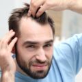 A young man indoors looking annoyed as he pulls back his hair to examine his M-shaped receding hairline.