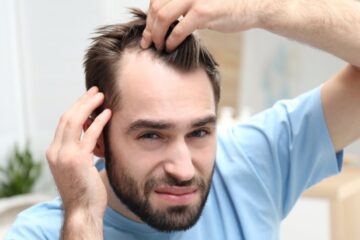 A young man indoors looking annoyed as he pulls back his hair to examine his M-shaped receding hairline.